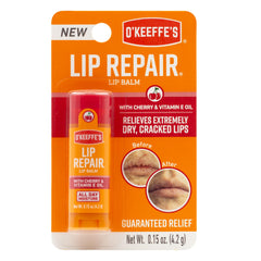 O'Keeffe's Lip Repair Chapstick Stick, Cherry & Vitamin E Oil Lip Balm for Dry Cracked Lips, Guaranteed Relief & All-Day Moisture in 1 Use, Lip Chap, 8 Moisturizing Ingredients, 1 Pack