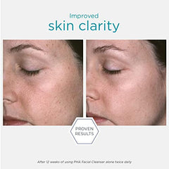 NeoStrata Restore PHA Facial Cleanser, 200 ml., 200 ml (Pack of 1)