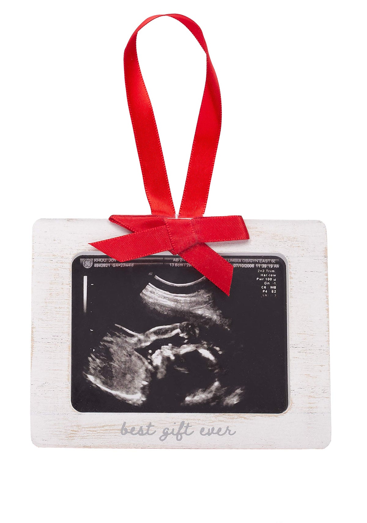 Pearhead Sonogram Picture Ornament with Burlap Ribbon and Wooden Frame | Ultrasound Photo Keepsake for Christmas Tree, Holiday Décor, and Pregnancy Announcement Gift