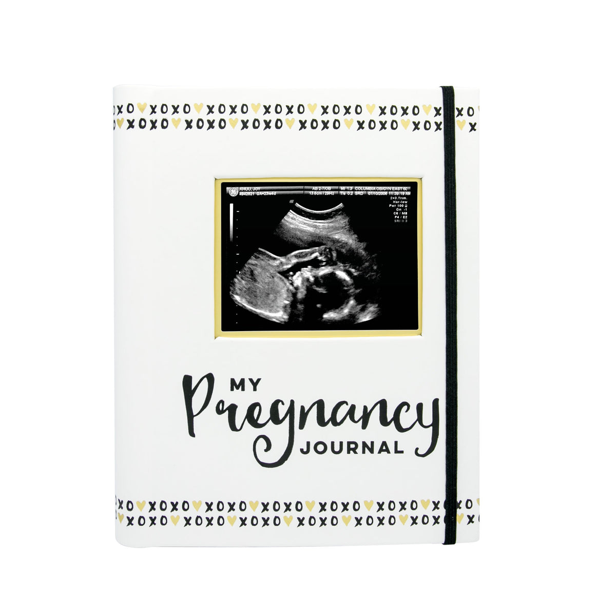 Pearhead Pregnancy Journal, White/Gold/Black