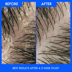 Head & Shoulders Full & Thick 2-in-1 Shampoo + Conditioner, 370ML